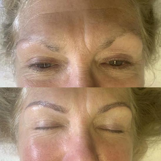 Microblading is a Service Offered by Innovative Aesthetics Skincare
